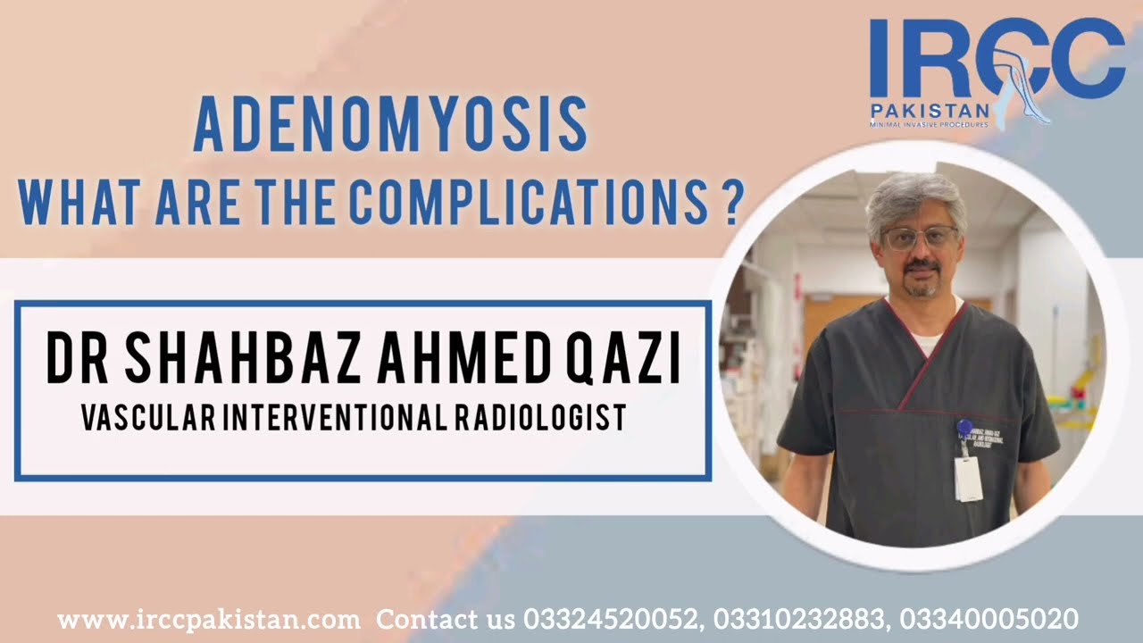 What are the complications of adenomyosis if don’t treat #adenomyosis #fibroid