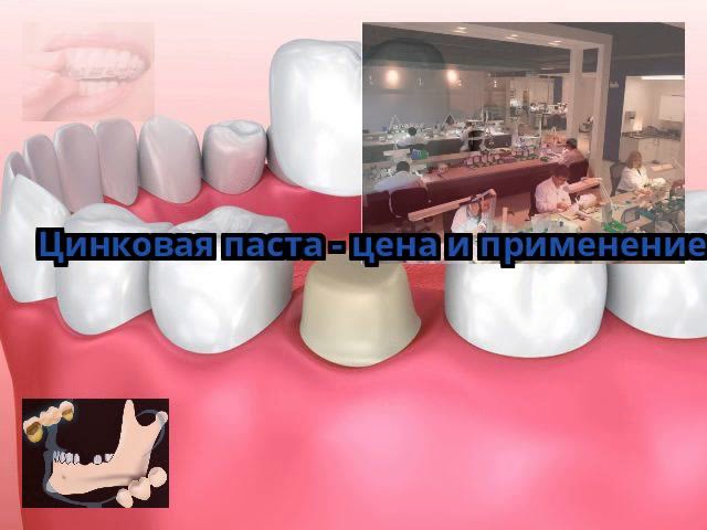 Цинковая паста - цена и применение