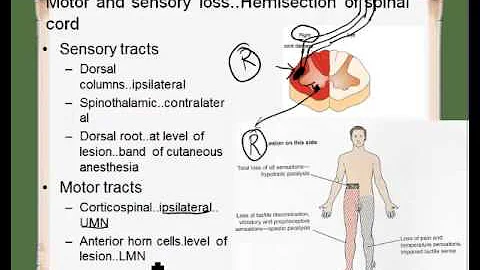 ipsilateral contralateral