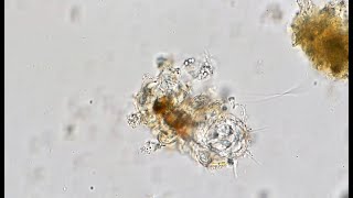 Possible Marine Tardigrade