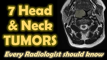 7 Head and Neck Tumors every Radiologist should know