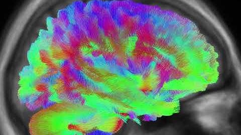 Whole brain tractogram of population template