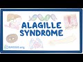 Alagille Syndrome- causes, symptoms, diagnosis, treatment, pathology
