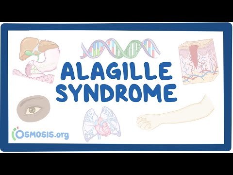 Alagille Syndrome- causes, symptoms, diagnosis, treatment, pathology