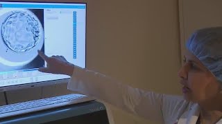 Ivf Treatment Isted By Ai