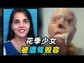 花季少女被酒驾毁容，变身反酒驾斗士，40岁因癌症去世