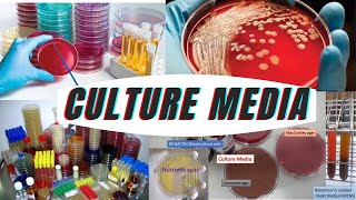 culture media | types of culture media | classification of culture media