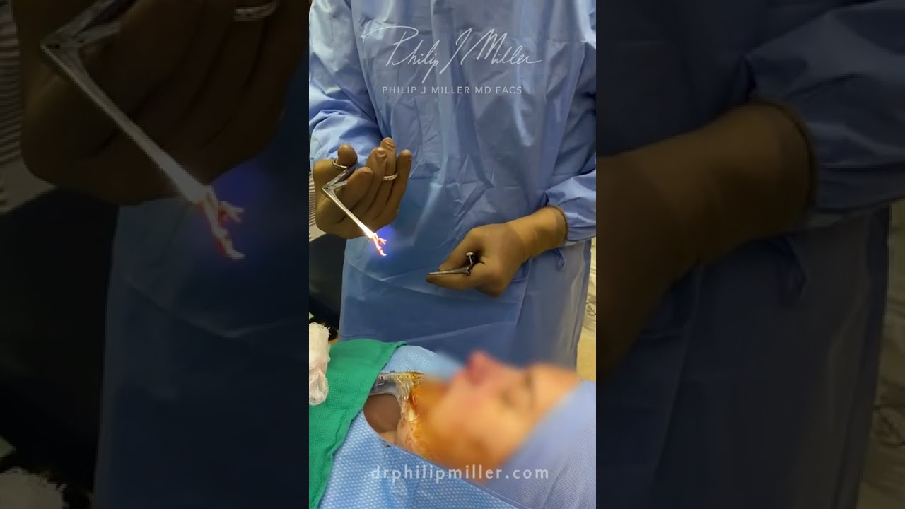 Deviated Septum, Why You Must Get It Fixed!