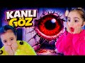 Kanlı göz. Evimize geldi. 