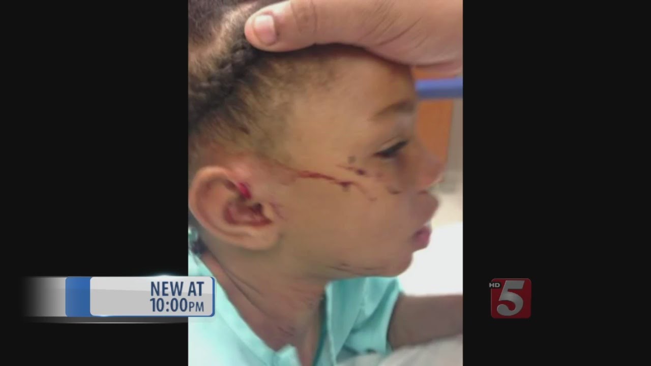 Hopkinsville Police Officer Suspended, K-9 Removed From Department Following Attack