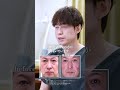 治療直後でも美しい、クマ取り治療