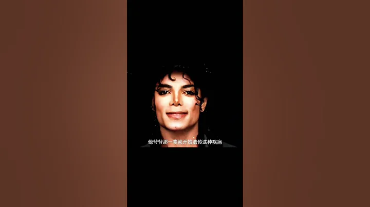 "邁克爾傑克遜他的皮膚由黑變白的原因 - 天天要聞
