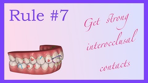Get Strong Interocclusal Contacts - Invisalign Mini Course 8 of 8