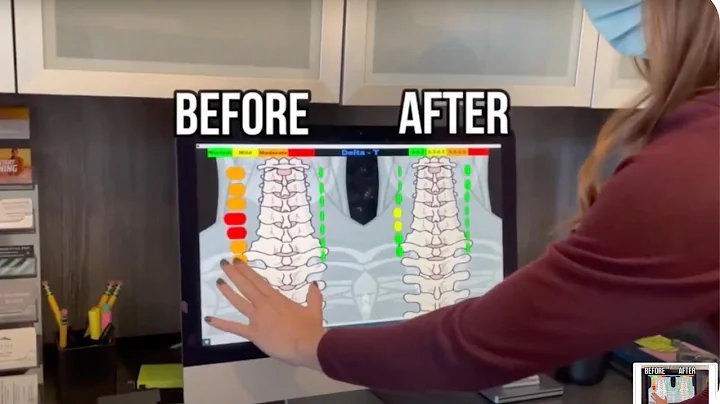 Behind The Scenes: Upper Cervical Chiropractic of ...