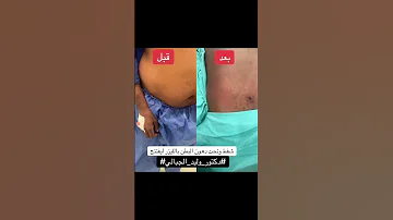 دكتور وليد الجبالي مصر امريكا تجميل معلمين في اي كار دبي السعوديه اوربا جده مشاهير دقي جيزه 
