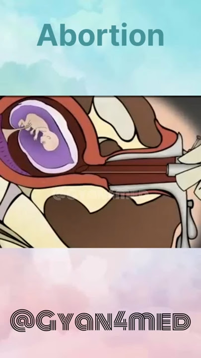 Memahami Aborsi: Animasi 3D #shorts #shortsvideos