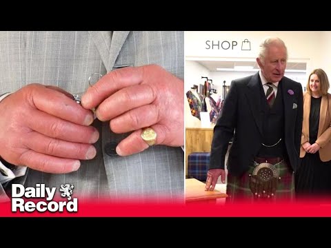 Medical reason behind King Charles&#039; &#039;sausage fingers&#039; and NHS advice for swollen hands