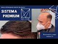 Sistema capilar Protesis de cabello baja densidad invisible nudo frontal blanqueado