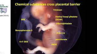 CHE Webinar: Deciphering Thyroid Hormone Disruption During Development