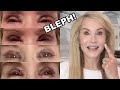 MY EYELID SURGERY! | FIRST TWO WEEKS OF RECOVERY VIDEO DIARY