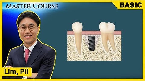 [Master Course Season2 - BASIC] Choosing Implants