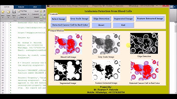 Leukemia Detection from Blood Cells Matlab Source Code