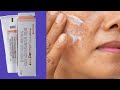 Demelan cream complete Information | Remove Pigmentation |Acne scars |Pimple marks|