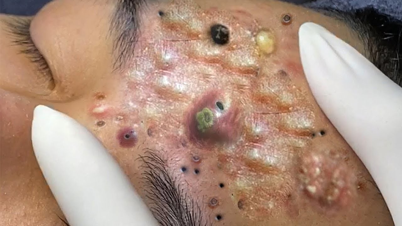 𝑺𝒐𝒐𝒕𝒉𝒊𝒏𝒈 𝑭𝒂𝒄𝒊𝒂𝒍 𝑻𝒓𝒆𝒂𝒕𝒎𝒆𝒏𝒕 𝒇𝒐𝒓 𝑺𝒕𝒓𝒆𝒔𝒔 𝑹𝒆𝒍𝒊𝒆𝒇 | 𝑫𝒆𝒆𝒑 𝑪𝒍𝒆𝒂𝒏𝒊𝒏𝒈 & 𝑪𝒂𝒍𝒎𝒊𝒏𝒈 𝑴𝒂𝒔𝒔𝒂𝒈𝒆 𝒂𝒕 𝑳𝒖𝒙𝒖𝒓𝒚 𝑺𝒑𝒂 #887654