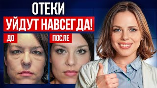 5 МИНУТ и отёков как НЕ БЫВАЛО! / Простые упражнения для разгона лимфы!