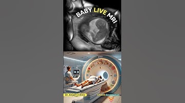 A Peek Inside Baby’s First MRI Journey | Pregnancy Guide | Fetal development #pregnancy #baby
