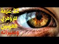 زوهري العينين 22 علامة للزوهري العينين وبعض مميزاته 