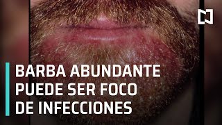 Barba abundante podría concentrar bacterias y parásitos - En Punto