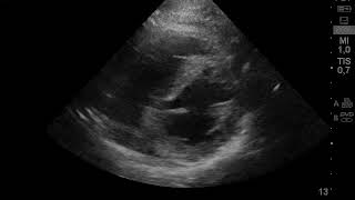 A4c (apical 4 cรกmaras)