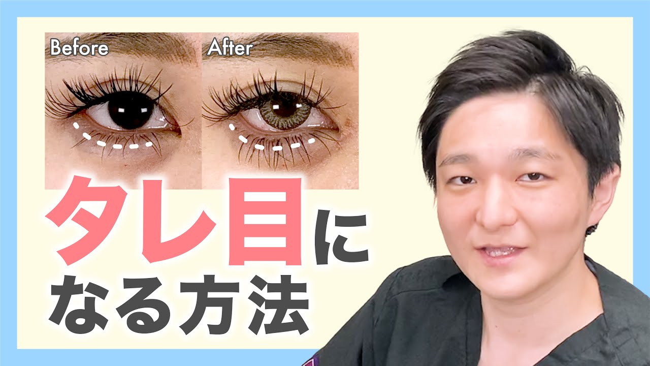 二重整形 可愛らしいタレ目になるには 目を大きく見せるタレ目術のお話 湘南美容クリニック Youtube 二重整形 可愛らしいタレ目になるには 目を大きく見せるタレ目術のお話 湘南美容クリニック Youtube