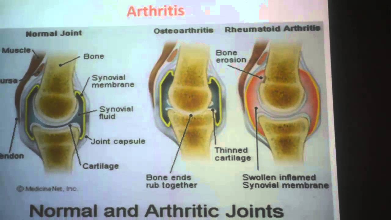 Musculoskeletal Problems