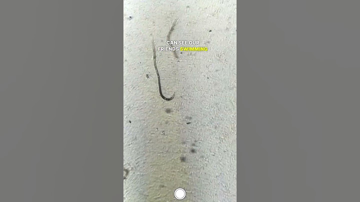 Does Lime Kill Parasites in Ceviche? #microscope #science #ceviche