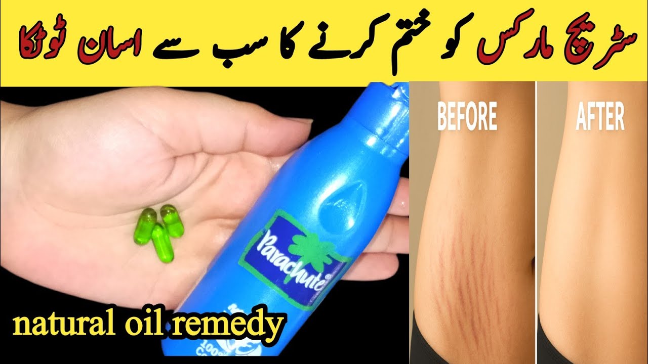 Stretch Marks Door Karne Ka Asan Totka" | Aloe Vera Oil Remedy | Totkay with Nida"
