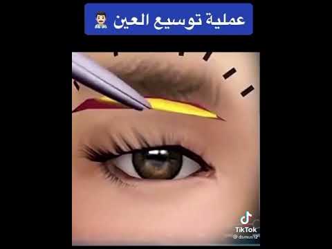 فيديو: هل يمكنك شق الرافعة؟