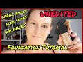 flawless foundation application | large pores,acne scars,oily,wrinkles