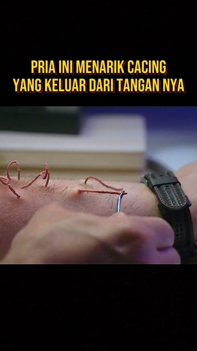 THIS MAN PANICED WHEN WORMS COME OUT OF HIS HANDS #filmstoryline #film