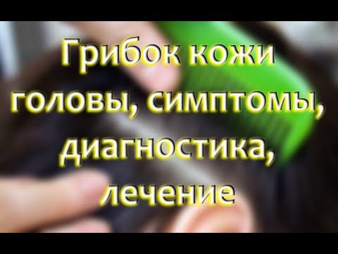 Грибок кожи головы: как распознать, симптомы и лечение