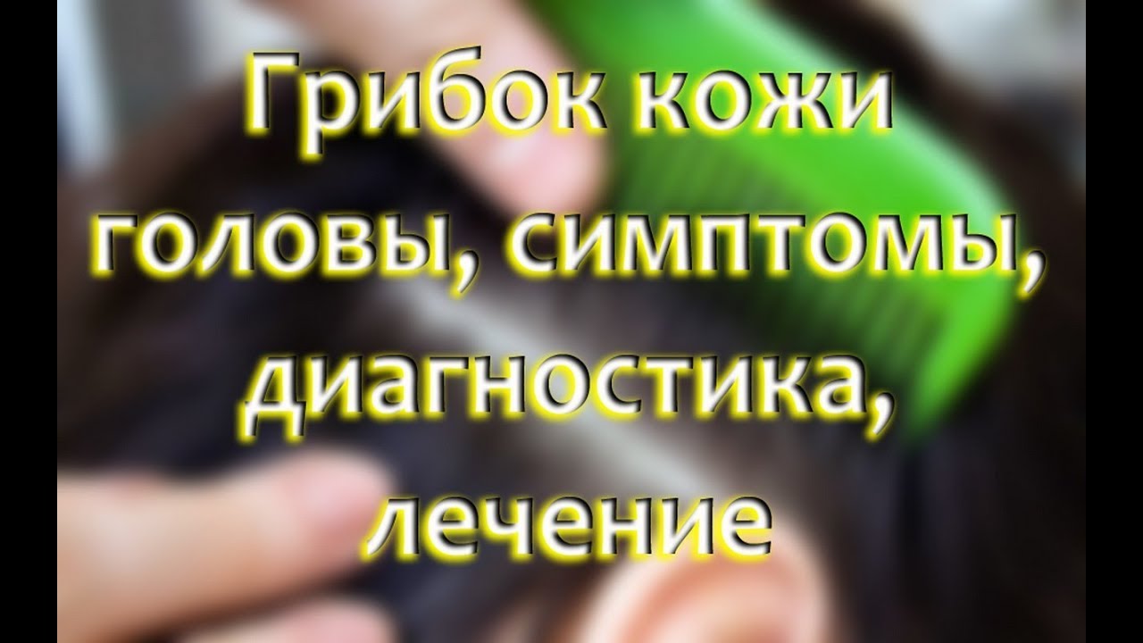Грибок кожи головы: как распознать, симптомы и лечение