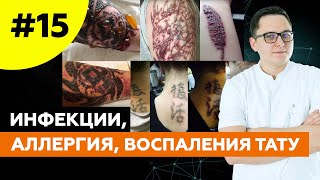 Осложнения татуажа и тату. Разбор кейсов #осложнениятату #удалениетату Осложнения татуажа и тату. Разбор кейсов #осложнениятату #удалениетату