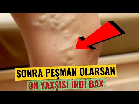 Video: Mikroskop altında insan orqanizminə foto səyahət