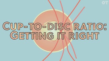 Kop-schijfverhouding: hoe doe je dat? | OT Skills Guide