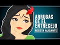 ARRUGAS DE EL ENTRECEJO