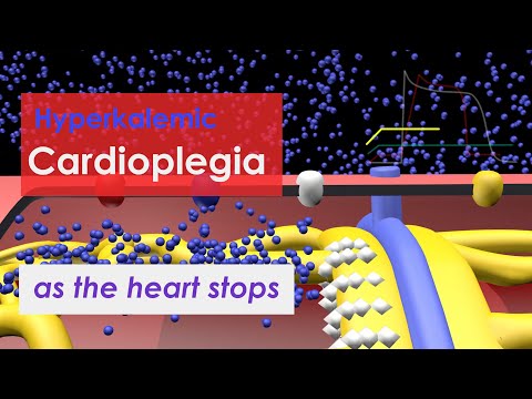Video: Kas ir asins kardiopleģija?
