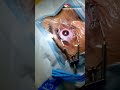 The Day You Say Goodbye to Glasses 👓✨ | LASIK Journey at Shriram Eye Hospital