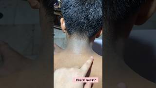 Black Neck Solution #Shorts #skincare Resimi