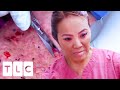Cyst That Makes Noise and a "Reverse Boob Job" | Dr. Pimple Popper